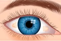 PREVENTIVNÍ SCREENING ZRAKU